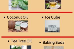 Top 10 Home Remedies for Pimples Overnight