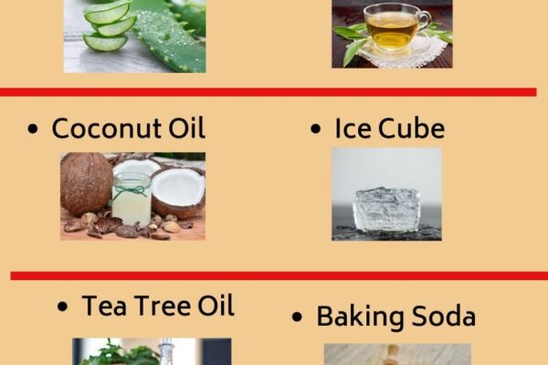 Top 10 Home Remedies for Pimples Overnight
