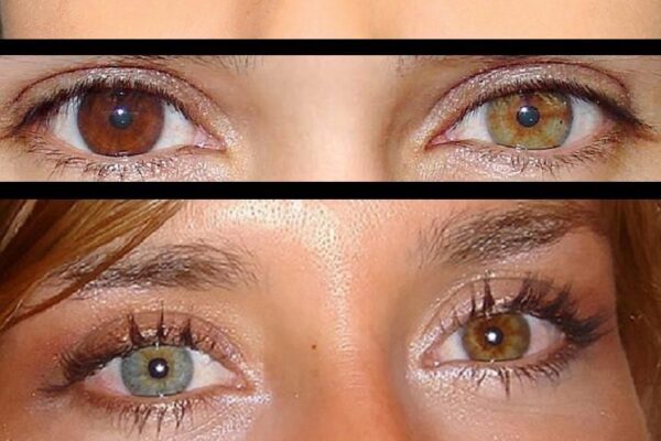 Top 10 Rarest Eye Colors in Humans Ranked