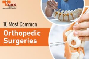 Top 10 Most Common Orthopedic Surgeries